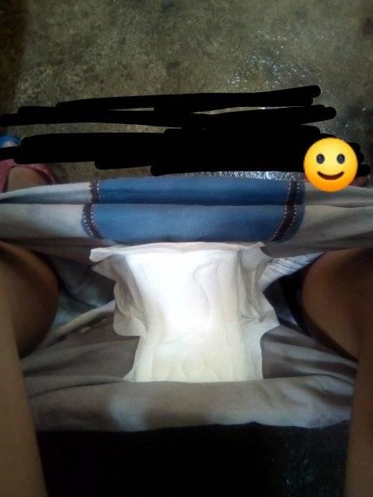 Sanitary Napkin