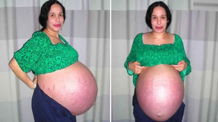 octomom pregnant