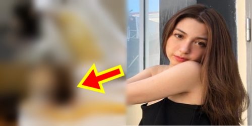 Donnalyn Bartolome Snake B 3