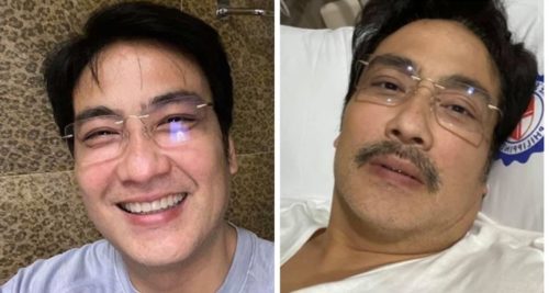 Bong Revilla