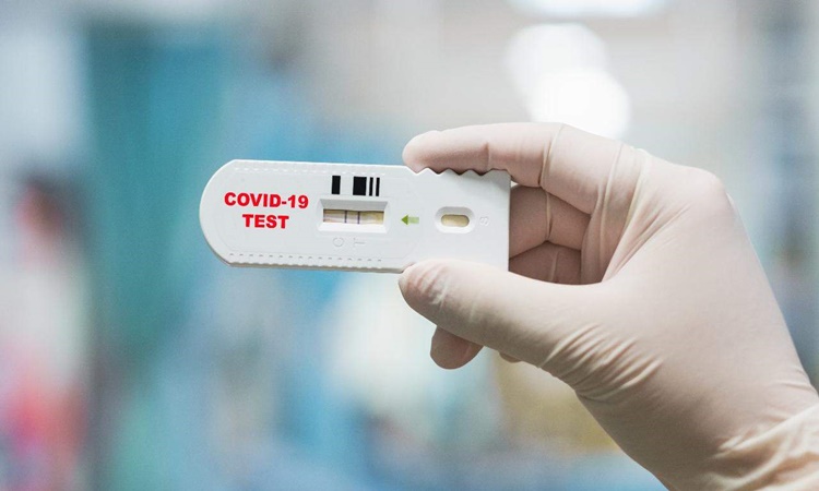 DOH-rapid-antibody-tests-RATs-1