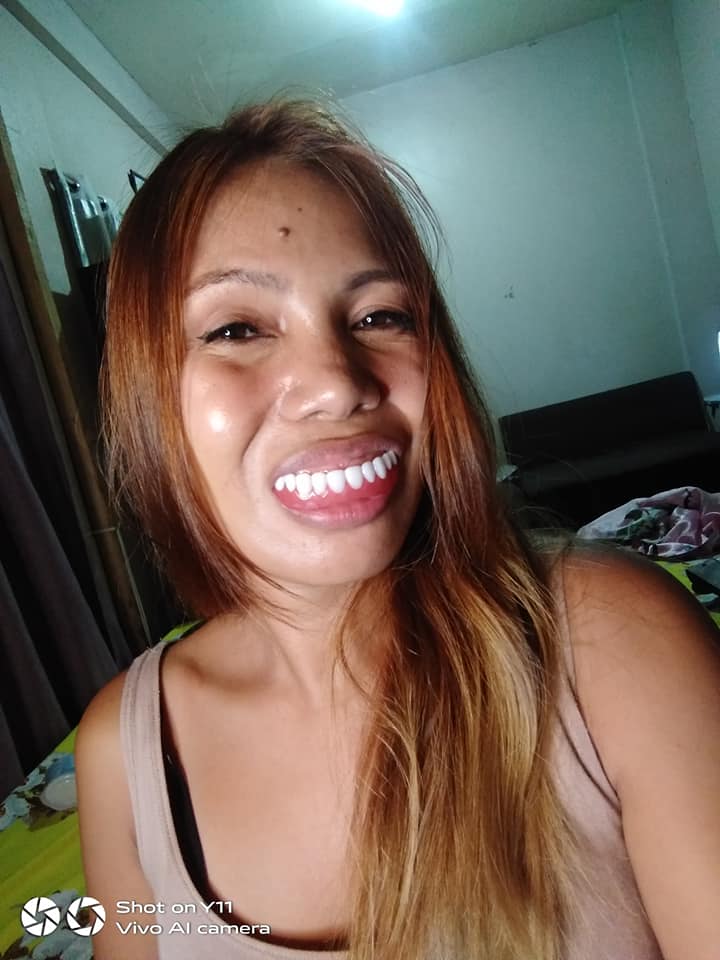 Veneers Teeth