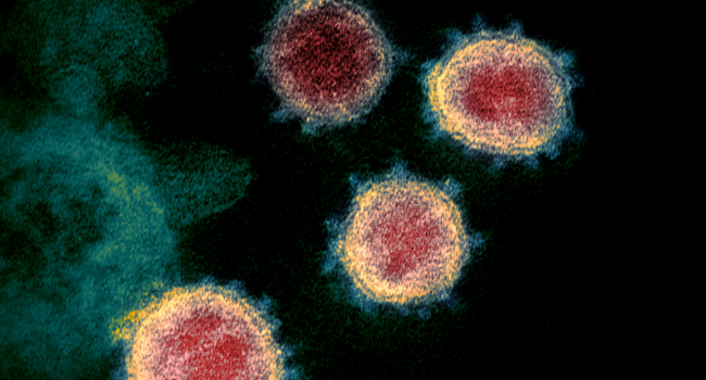 Virus Mutation In Cebu Expected But More Study Required – Virus Expert
