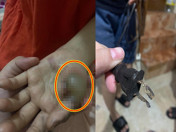 Young Girl Suffers Injuries After Extension Cord Blasts