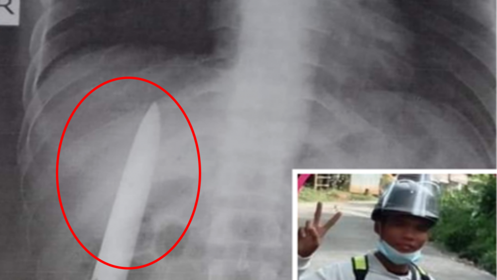 Man Knife in Body