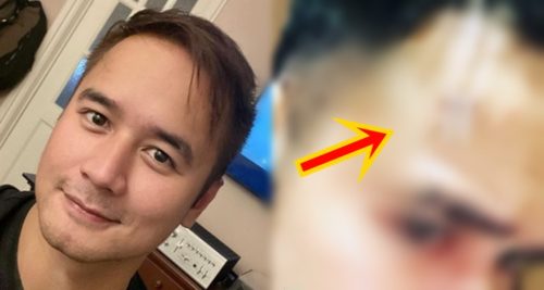 jm de guzman accident