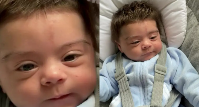 Premature Baby Born With Magnificent Hair Goes Viral