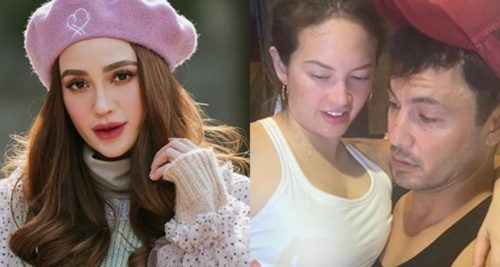 arci munoz derek ramsay ell