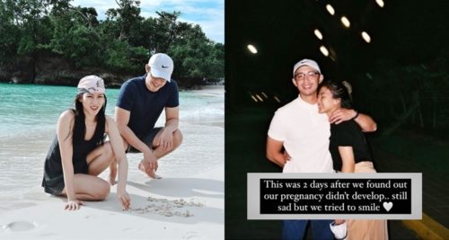 Alex Gonzaga and Mikee Morada