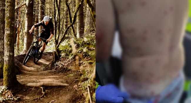 Mountain Biker Shot After Hunters Thought He Was A Rabbit