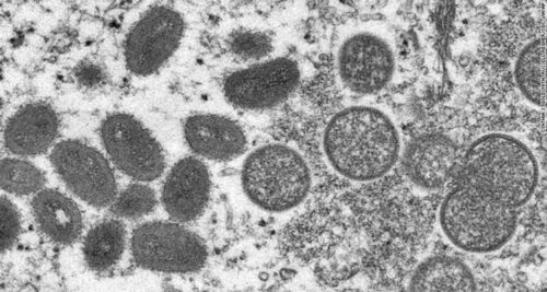 Monkeypox Virus