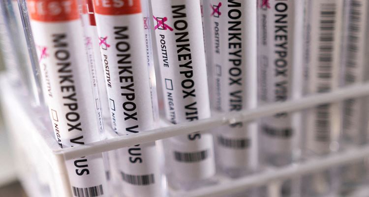 Monkeypox Virus
