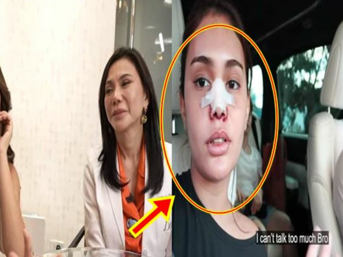 Ivana Alawi Undergoes Nose Restructuring? This Is Her Family's Reaction