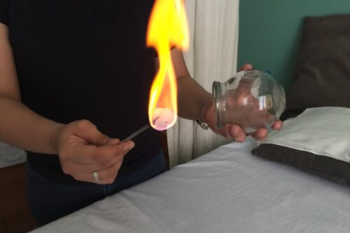 Second-Degree Burn