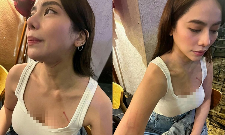 Debbie Garcia Files Complaint Against Barbie Imperial After Bar Incident 1869