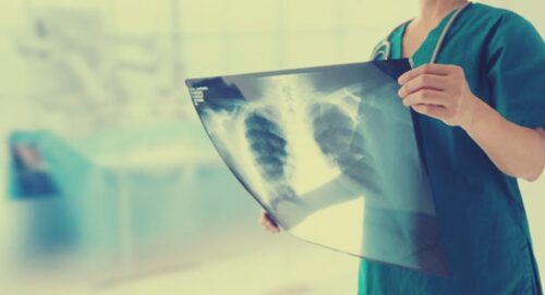 X-Ray Technology Board Exam Result