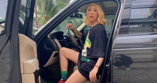 Vice Ganda Car Accident