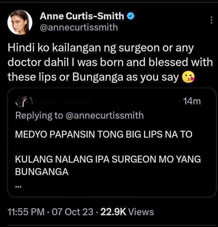 Anne Curtis