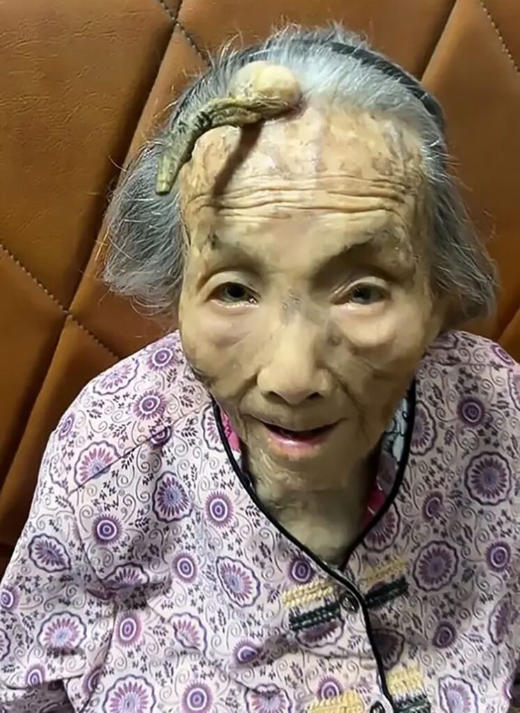 107-Year-Old Woman