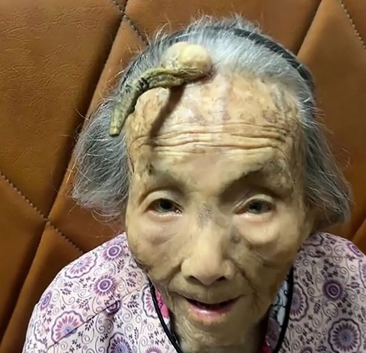 107-Year-Old Woman