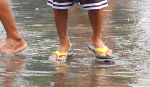 Leptospirosis