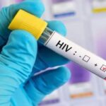 HIV 1