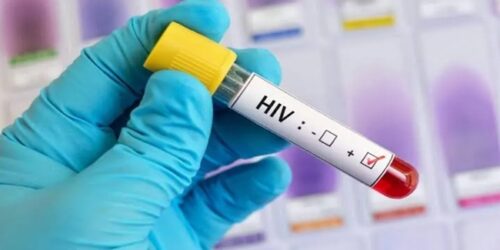 HIV 1