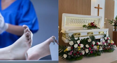 embalmer