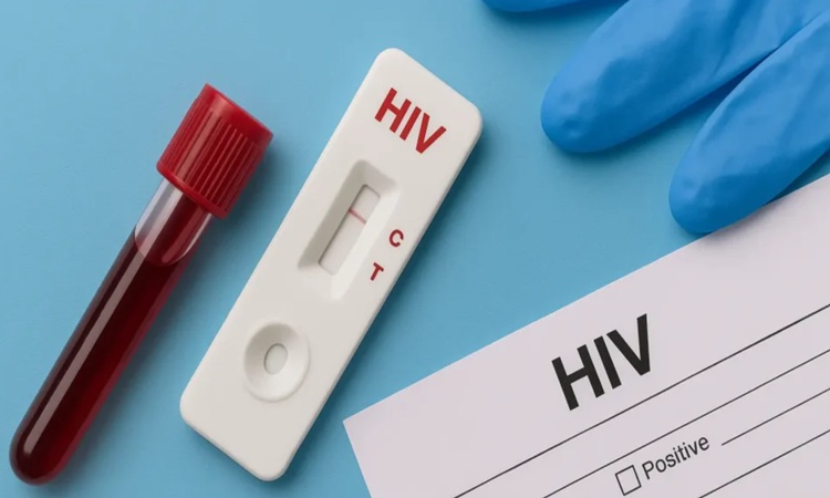 HIV
