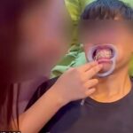 DIY Braces Service