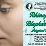 rhinoplasty